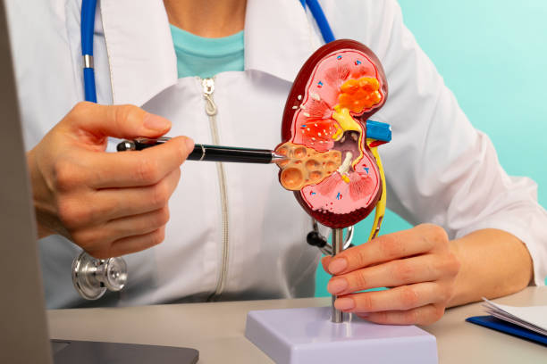 Best Doctor For Kidney Stone Treatment In Vashi